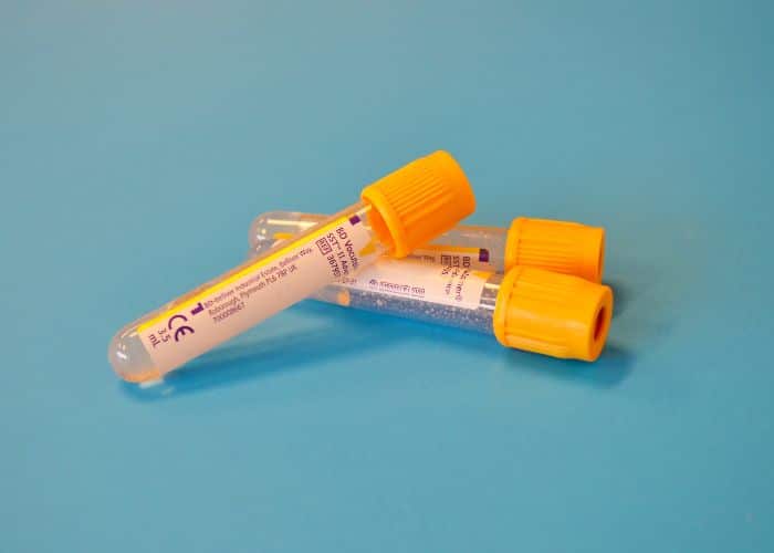 blood test tubes